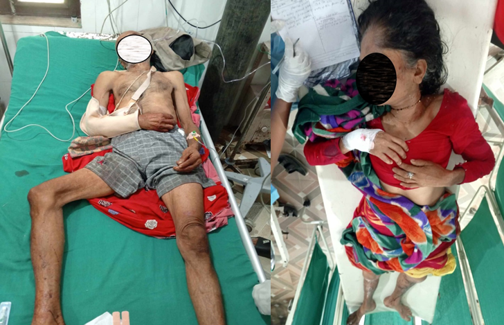 कावासोतीमा छोराको कुटपिटबाट बावुआमा घाइते